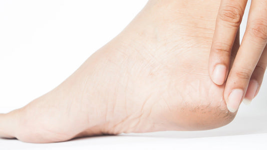 What Is a Foot Peeling Mask and How Does It Work? - Maskory