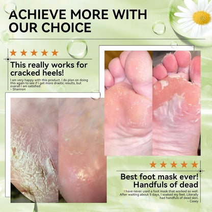 LANBENA Aloe Vera Foot Peel Mask – Gentle Exfoliation & Hydration for Baby-Soft Feet
