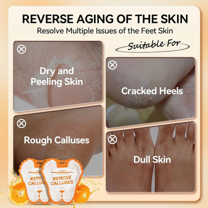 LANBENA Vitamin C Foot Peel Mask – Gentle Exfoliation & Brightening for Smooth, Soft Feet