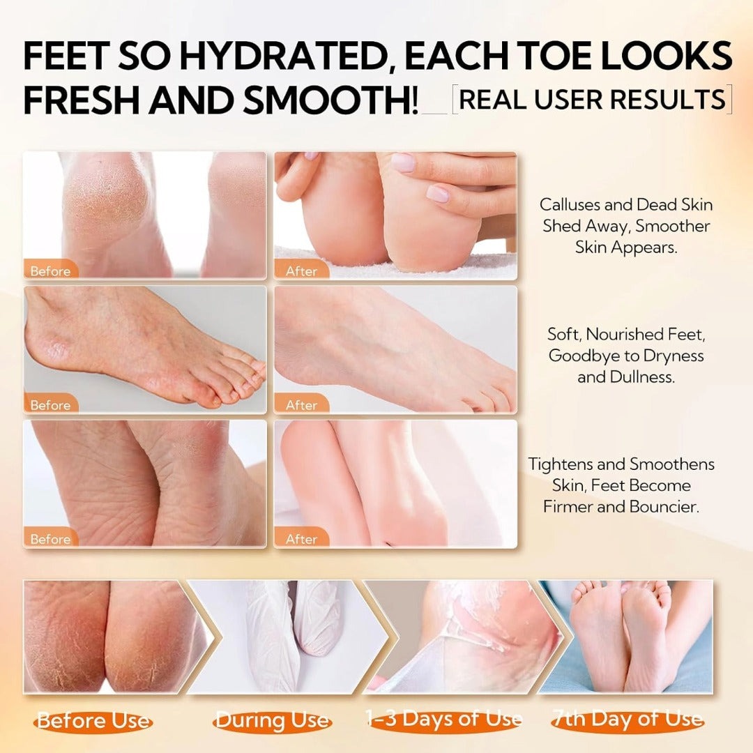 LANBENA Vitamin C Foot Peel Mask – Gentle Exfoliation & Brightening for Smooth, Soft Feet