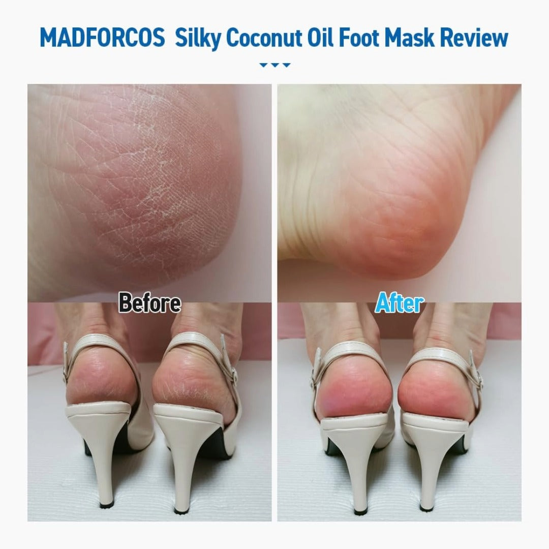MADFORCOS Silky Coconut Oil Foot Mask – Ultra-Nourishing Moisture Therapy for Dry Feet
