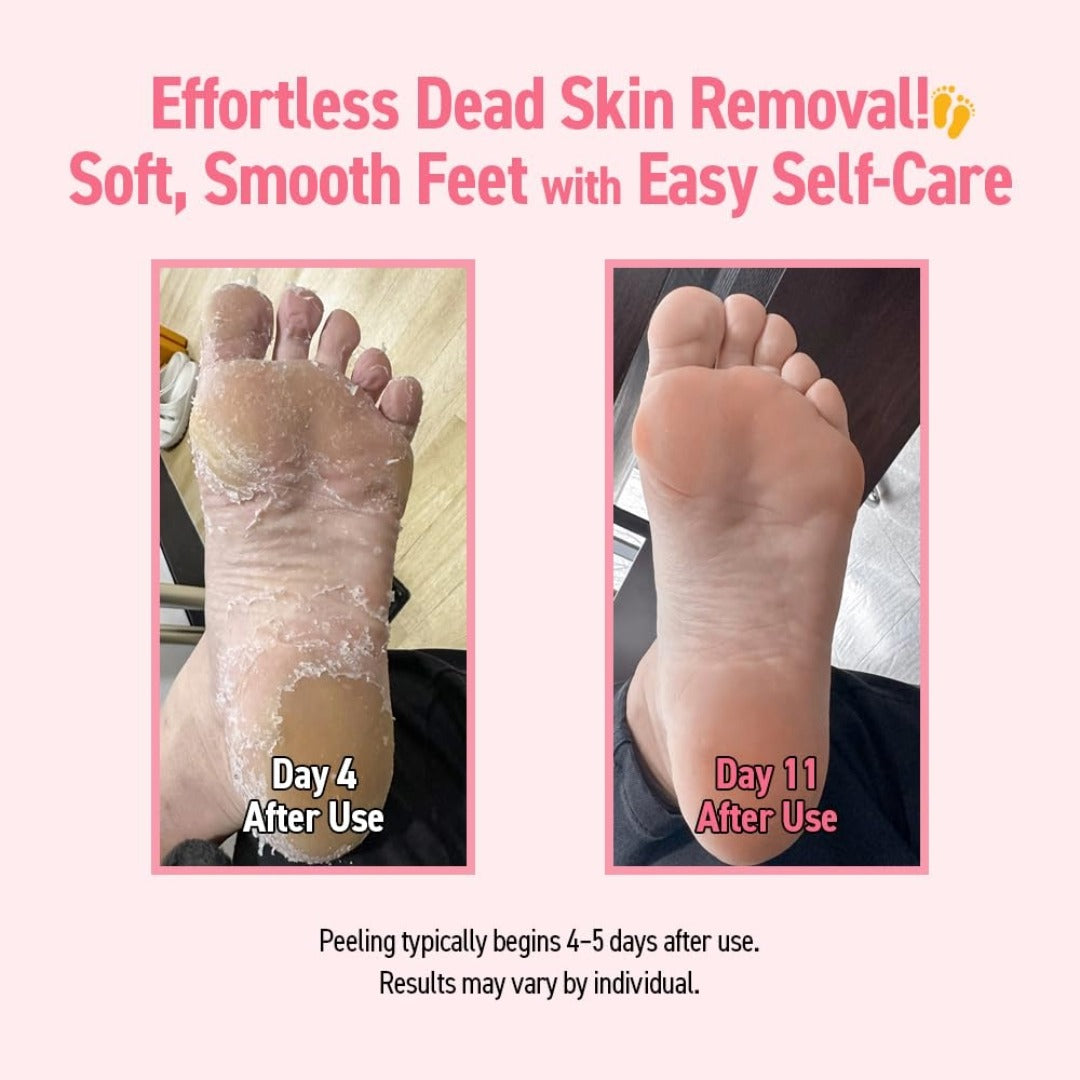 Madforcos Silky Smooth Foot Peeling Mask – Gentle Exfoliation for Baby-Soft Feet
