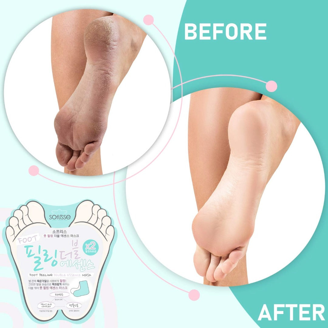 Soflisse Foot Peeling Double Essence Mask – Intensive Hydration & Elasticity Boost for Dry Feet