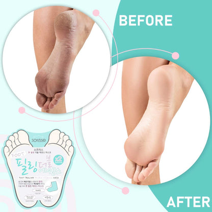Soflisse Foot Peeling Double Essence Mask – Intensive Hydration & Elasticity Boost for Dry Feet
