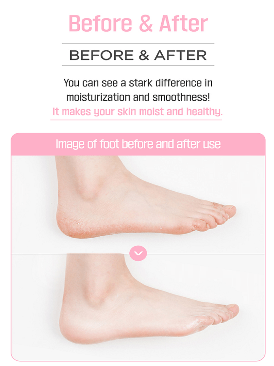 Angellooka Heating Foot Pack – Self - Warming Moisturizing Foot Mask - Maskory