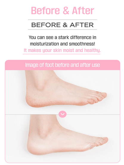 Angellooka Heating Foot Pack – Self - Warming Moisturizing Foot Mask - Maskory