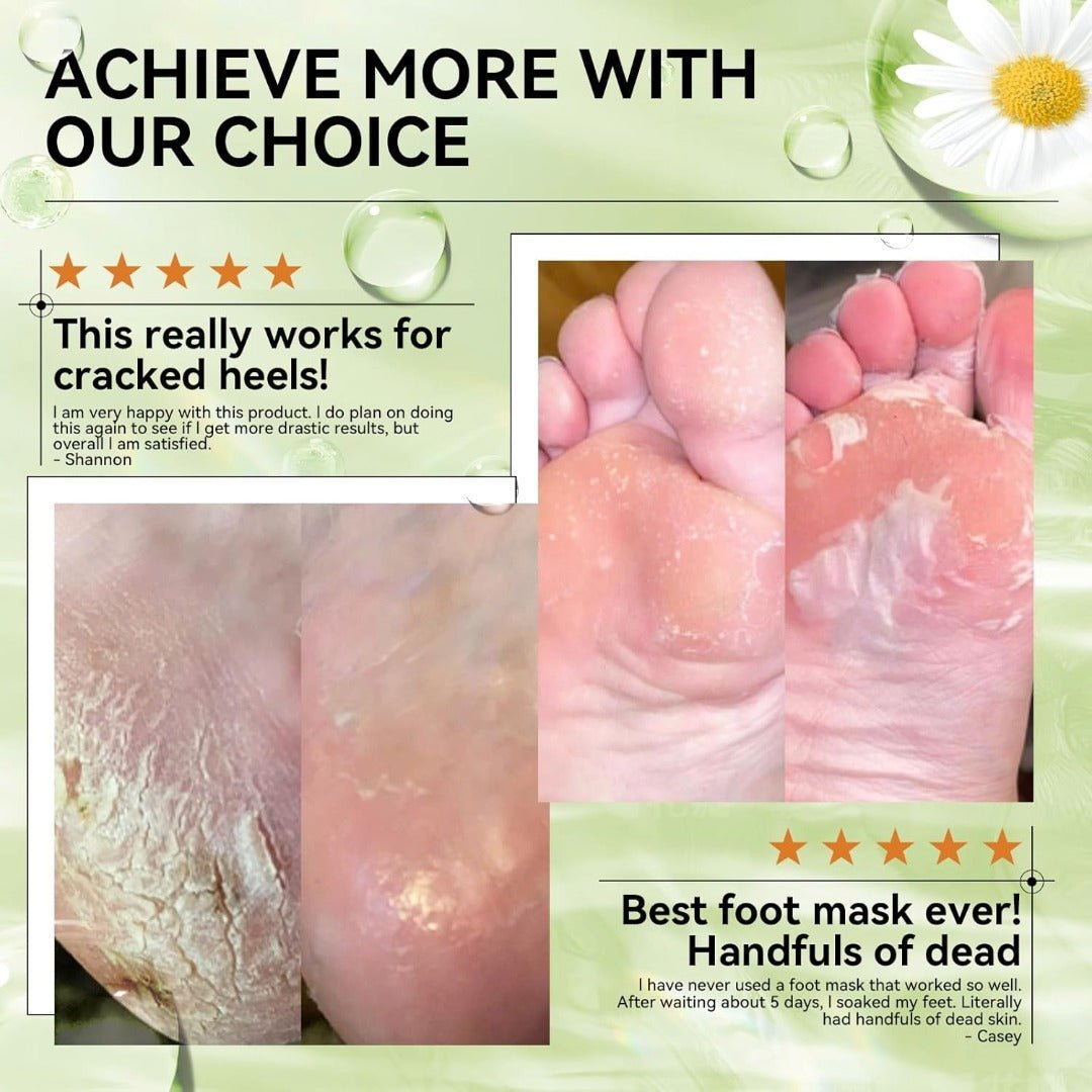 LANBENA Aloe Vera Foot Peel Mask – Gentle Exfoliation & Hydration for Baby - Soft Feet - Maskory
