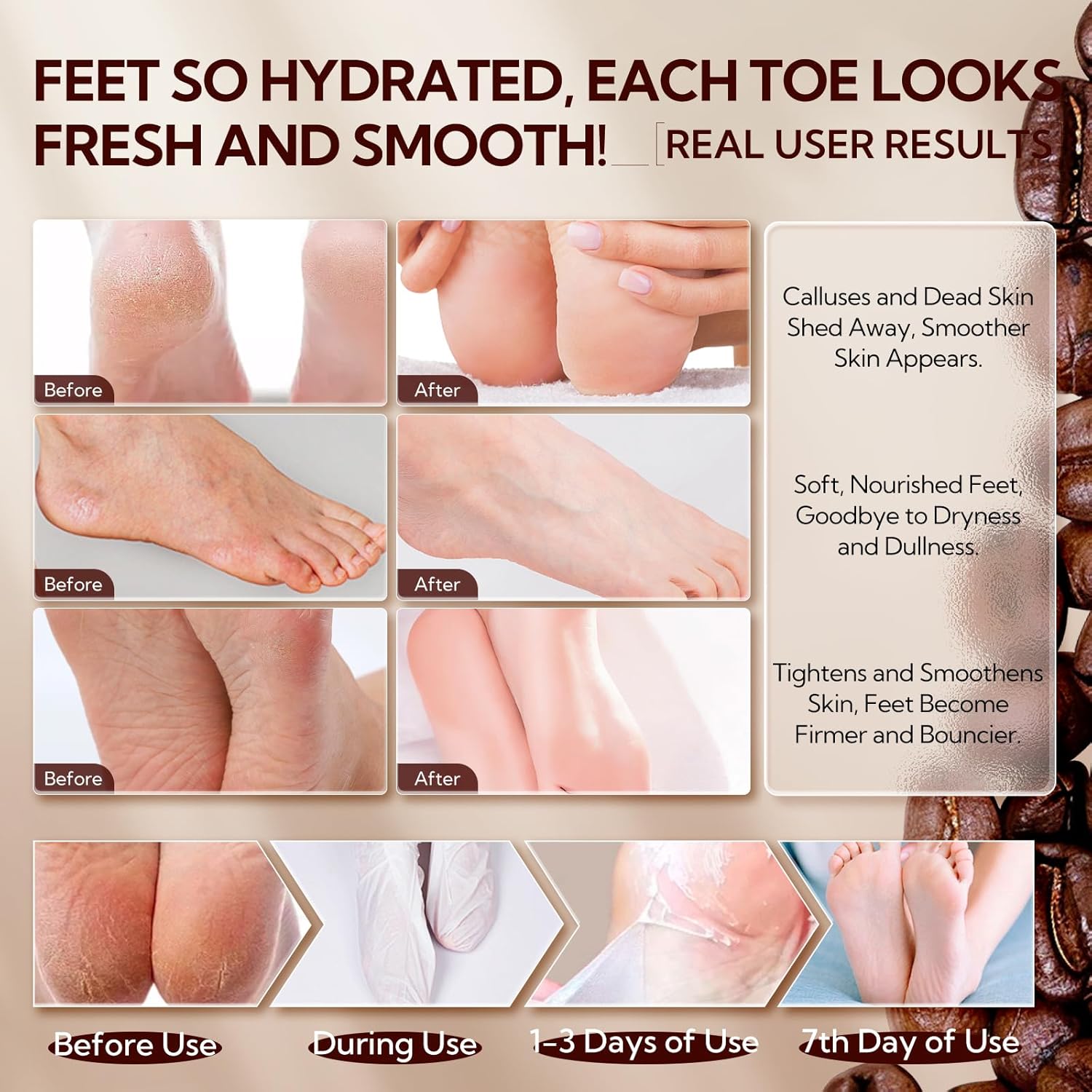 LANBENA Coffee Foot Peel Mask – Exfoliating Sock Mask for Dry, Callused Feet, Softening & Hydrating - Maskory