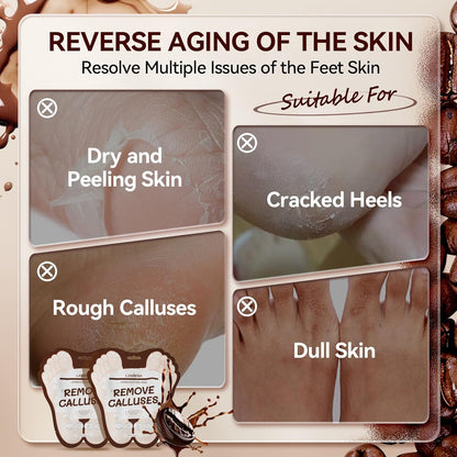 LANBENA Coffee Foot Peel Mask – Exfoliating Sock Mask for Dry, Callused Feet, Softening & Hydrating - Maskory