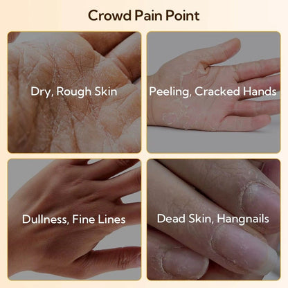 LANBENA Hyaluronic Acid Hand Mask – Deep Hydration & Soothing Care for Soft, Plumped Hands - Maskory