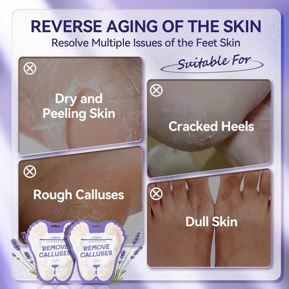 LANBENA Lavender Foot Peel Mask – Exfoliation & Calming Care for Smooth, Refreshed Feet - Maskory