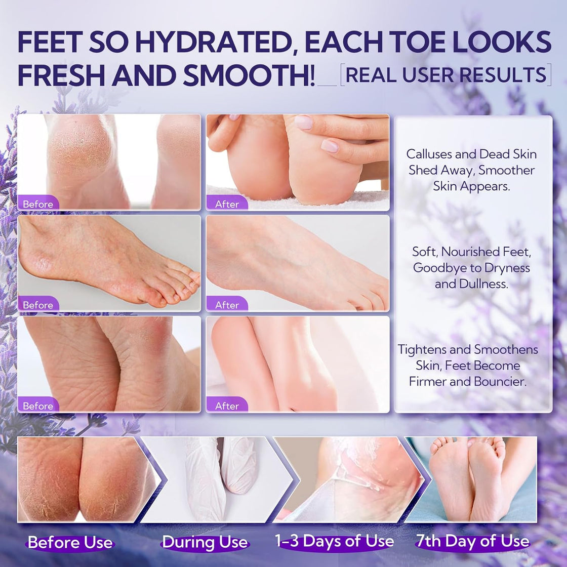 LANBENA Lavender Foot Peel Mask – Exfoliation & Calming Care for Smooth, Refreshed Feet - Maskory