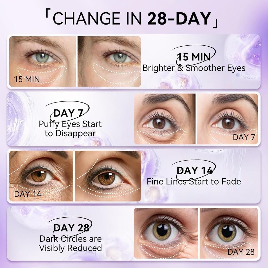 LANBENA Rejuvenating Retinol Hydra - Gel Eye Patches - Maskory