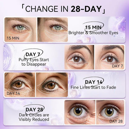 LANBENA Rejuvenating Retinol Hydra - Gel Eye Patches - Maskory