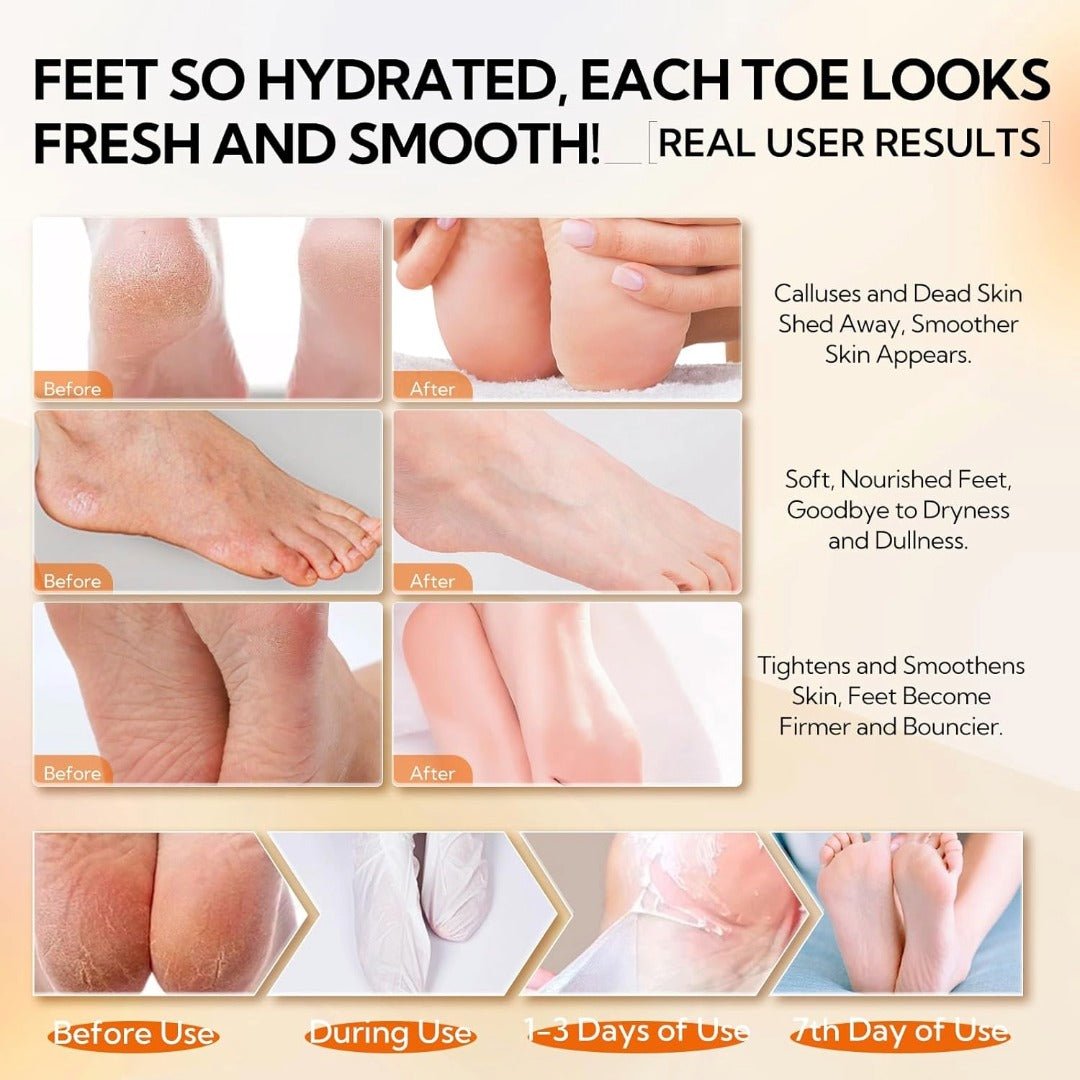 LANBENA Vitamin C Foot Peel Mask – Gentle Exfoliation & Brightening for Smooth, Soft Feet - Maskory