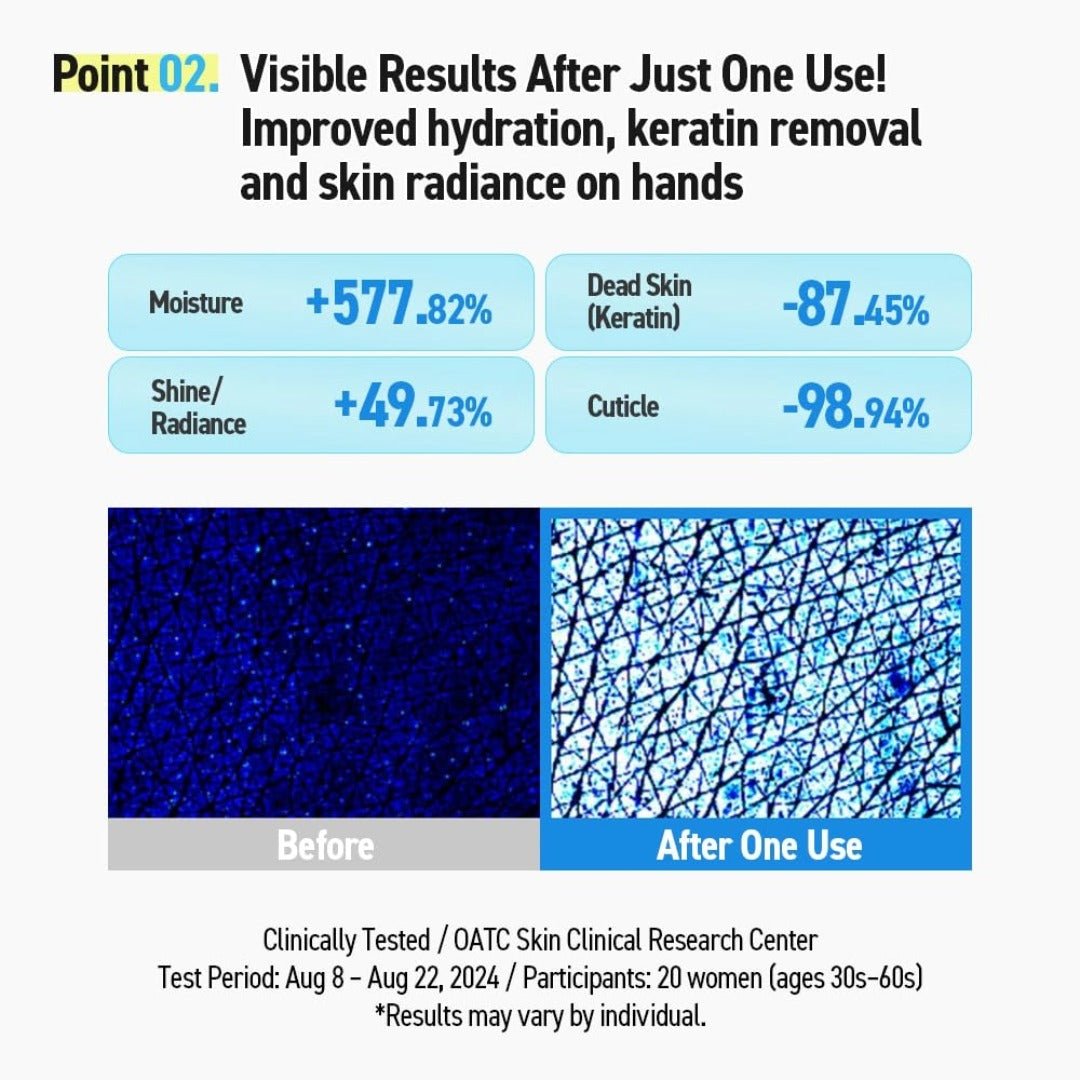 MADFORCOS Milky Moisture Hand Mask – Intensive Hydration & Softening for Dry, Tired Hands - Maskory